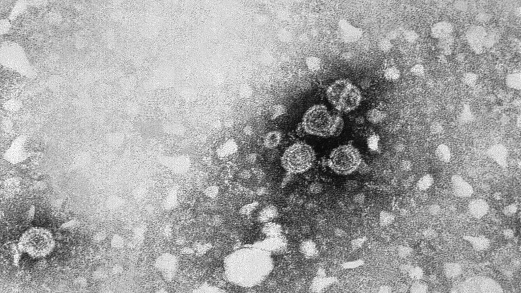 Electron micrograph of hepatitis B virus particles